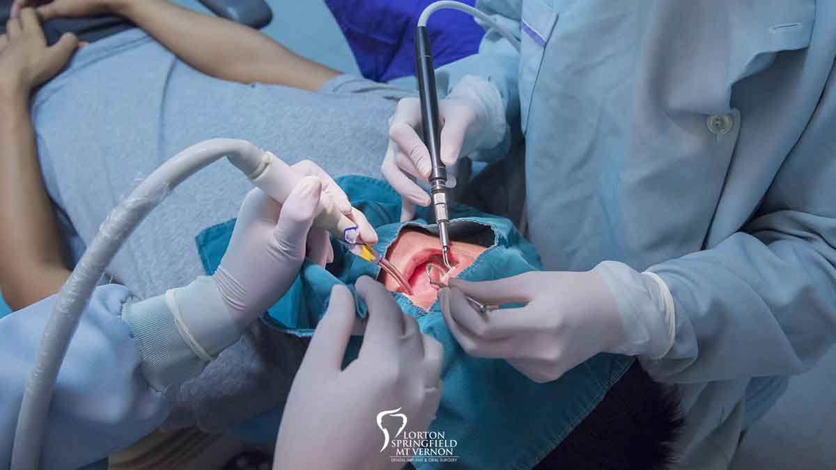 Oral & Maxillofacial treatment in Warangal